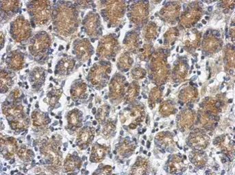 Anti-RUNDC1 antibody used in IHC (Paraffin sections) (IHC-P). GTX122487