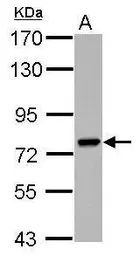 Anti-PARP6 antibody used in Western Blot (WB). GTX122488