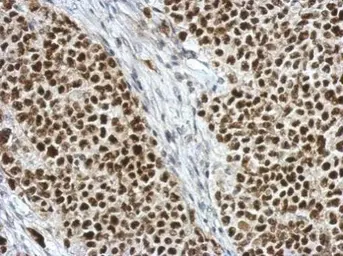 Anti-C17orf49 antibody used in IHC (Paraffin sections) (IHC-P). GTX122496