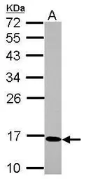Anti-C17orf49 antibody used in Western Blot (WB). GTX122496
