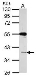 Anti-VSIG1 antibody used in Western Blot (WB). GTX122505