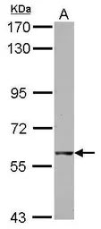 Anti-GTPBP2 antibody used in Western Blot (WB). GTX122509