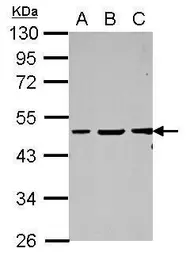 Anti-Vasculin antibody [N1N3] used in Western Blot (WB). GTX122517