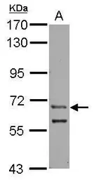 Anti-ZFY antibody [C1C3] used in Western Blot (WB). GTX122542