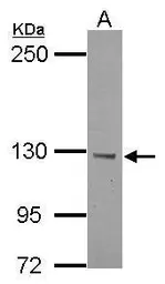 Anti-BTBD7 antibody [N1N2], N-term used in Western Blot (WB). GTX122545