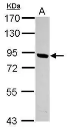 Anti-PNPLA8 antibody used in Western Blot (WB). GTX122550