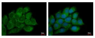 Anti-PECI antibody used in Immunocytochemistry/ Immunofluorescence (ICC/IF). GTX122557