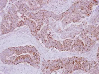 Anti-PECI antibody used in IHC (Paraffin sections) (IHC-P). GTX122557