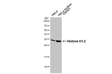 Anti-Histone H1.2 antibody used in Western Blot (WB). GTX122561