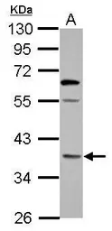Anti-OXNAD1 antibody used in Western Blot (WB). GTX122564
