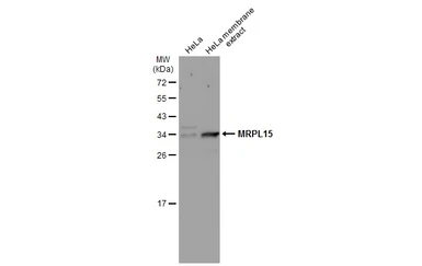 Anti-MRPL15 antibody used in Western Blot (WB). GTX122571