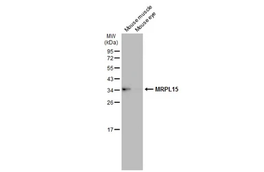 Anti-MRPL15 antibody used in Western Blot (WB). GTX122571