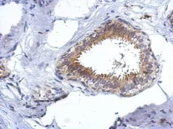 Anti-CCDC97 antibody used in IHC (Paraffin sections) (IHC-P). GTX122596