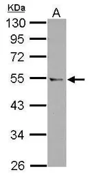Anti-CCDC97 antibody used in Western Blot (WB). GTX122596