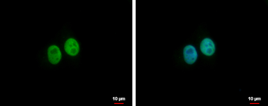 Anti-BRMS1L antibody used in Immunocytochemistry/ Immunofluorescence (ICC/IF). GTX122598