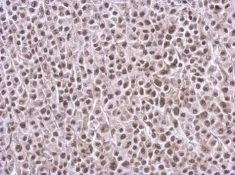 Anti-BRMS1L antibody used in IHC (Paraffin sections) (IHC-P). GTX122598