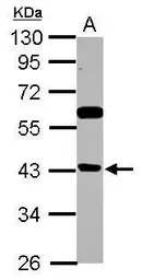 Anti-BRMS1L antibody used in Western Blot (WB). GTX122598
