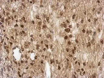 Anti-TBC1D22A antibody used in IHC (Paraffin sections) (IHC-P). GTX122604