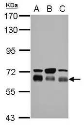 Anti-TBC1D22A antibody used in Western Blot (WB). GTX122604