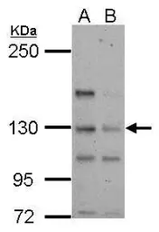 Anti-TTLL4 antibody [N3C1], Internal used in Western Blot (WB). GTX122610
