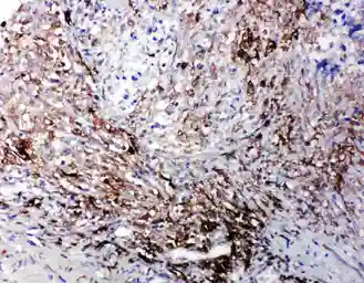 Anti-LTBR antibody used in IHC (Paraffin sections) (IHC-P). GTX12264