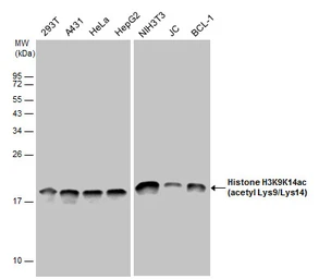 Anti-Histone H3K9K14ac (Acetyl Lys9/Lys14) antibody used in Western Blot (WB). GTX122648