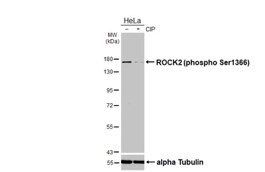 Anti-ROCK2 (phospho Ser1366) antibody used in Western Blot (WB). GTX122651