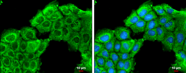 Anti-ROCK2 antibody used in Immunocytochemistry/ Immunofluorescence (ICC/IF). GTX122652