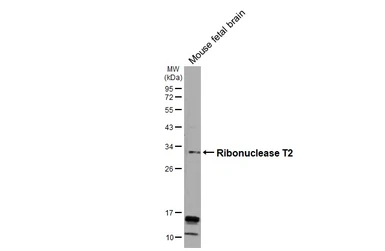 Anti-Ribonuclease T2 antibody [N1C3] used in Western Blot (WB). GTX122679