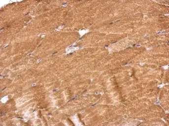 Anti-PROSC antibody used in IHC (Paraffin sections) (IHC-P). GTX122706