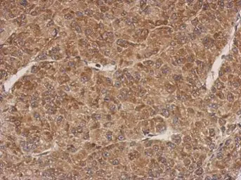 Anti-PROSC antibody used in IHC (Paraffin sections) (IHC-P). GTX122706