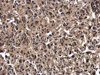 Anti-ZFAT antibody used in IHC (Paraffin sections) (IHC-P). GTX122715