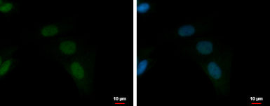 Anti-ZFAT antibody used in Immunocytochemistry/ Immunofluorescence (ICC/IF). GTX122715
