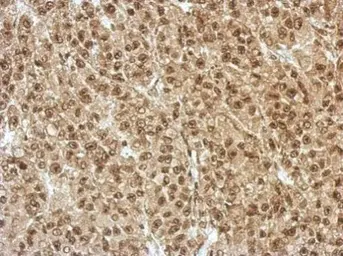 Anti-ZFAT antibody used in IHC (Paraffin sections) (IHC-P). GTX122715
