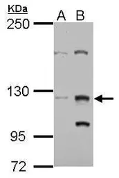 Anti-ZFAT antibody used in Western Blot (WB). GTX122715
