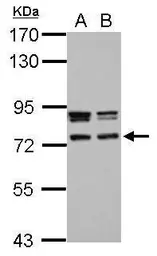 Anti-CCDC151 antibody used in Western Blot (WB). GTX122743