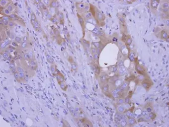 Anti-COL4A3BP antibody used in IHC (Paraffin sections) (IHC-P). GTX122753
