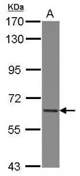 Anti-COL4A3BP antibody used in Western Blot (WB). GTX122753