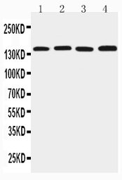 Anti-ZO-2 antibody used in Western Blot (WB). GTX12276