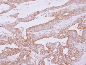 Anti-THUMPD2 antibody used in IHC (Paraffin sections) (IHC-P). GTX122789