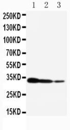 Anti-TORC2 antibody used in Western Blot (WB). GTX12282