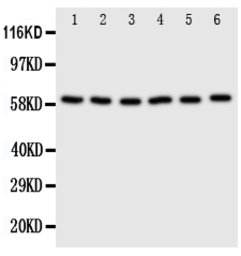 Anti-SCLY antibody used in Western Blot (WB). GTX12283