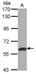 Anti-RSPRY1 antibody [N1C1] used in Western Blot (WB). GTX122869