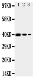 Anti-TRAM2 antibody used in Western Blot (WB). GTX12287