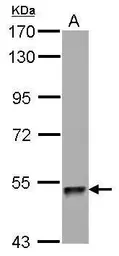 Anti-ZNF689 antibody used in Western Blot (WB). GTX122872