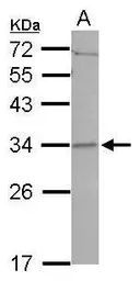 Anti-CCDC127 antibody used in Western Blot (WB). GTX122888