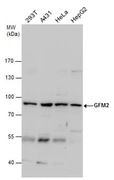 Anti-GFM2 antibody [N3C2], Internal used in Western Blot (WB). GTX122890