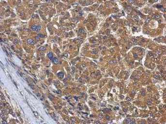 Anti-KLHL22 antibody used in IHC (Paraffin sections) (IHC-P). GTX122894