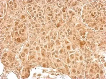 Anti-LCMT2 antibody used in IHC (Paraffin sections) (IHC-P). GTX122895
