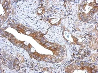 Anti-GCNT3 antibody used in IHC (Paraffin sections) (IHC-P). GTX122901